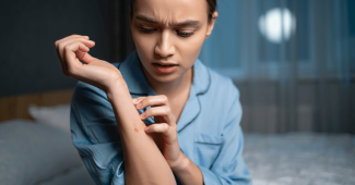 Dermatite atopique : comprendre pourquoi la nuit devient un vrai défi