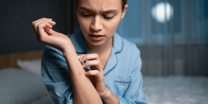 Dermatite atopique : comprendre pourquoi la nuit devient un vrai défi
