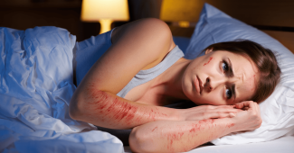 Dermatite atopique : comprendre pourquoi la nuit devient un vrai défi