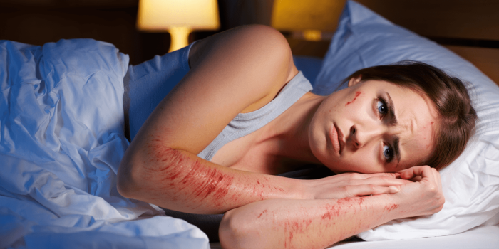 Dermatite atopique : comprendre pourquoi la nuit devient un vrai défi