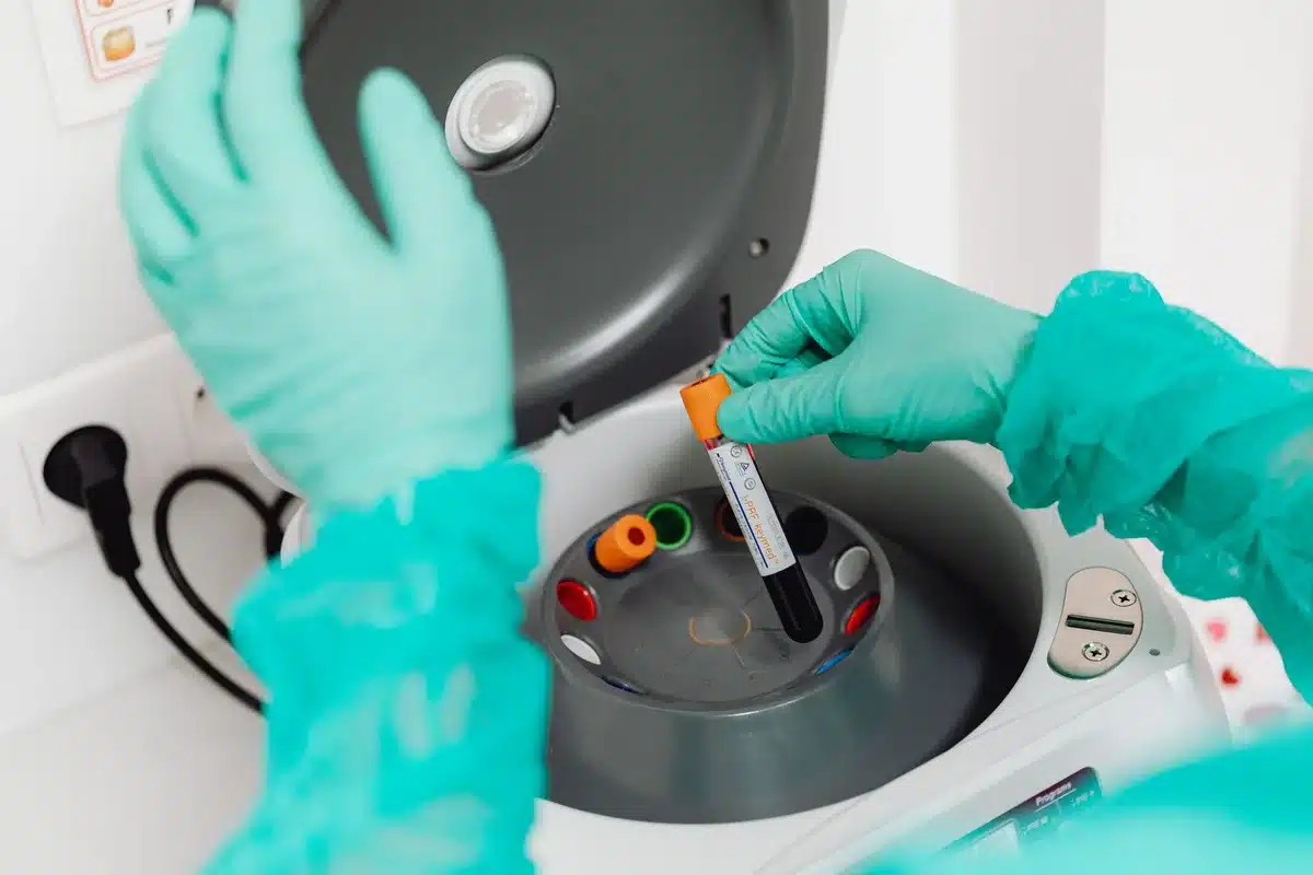 Analyse sanguine en laboratoire pour déterminer les niveaux de phosphate sérique