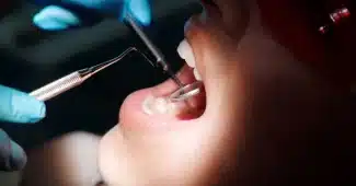 Enfant chez le dentiste lors d'un examen dentaire montrant une inflammation dentaire