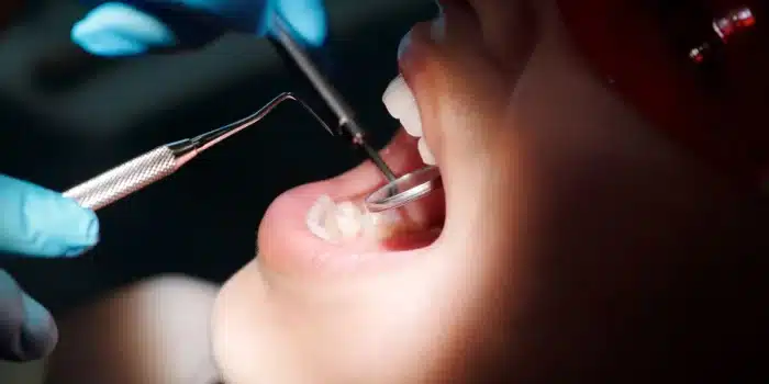 Enfant chez le dentiste lors d'un examen dentaire montrant une inflammation dentaire