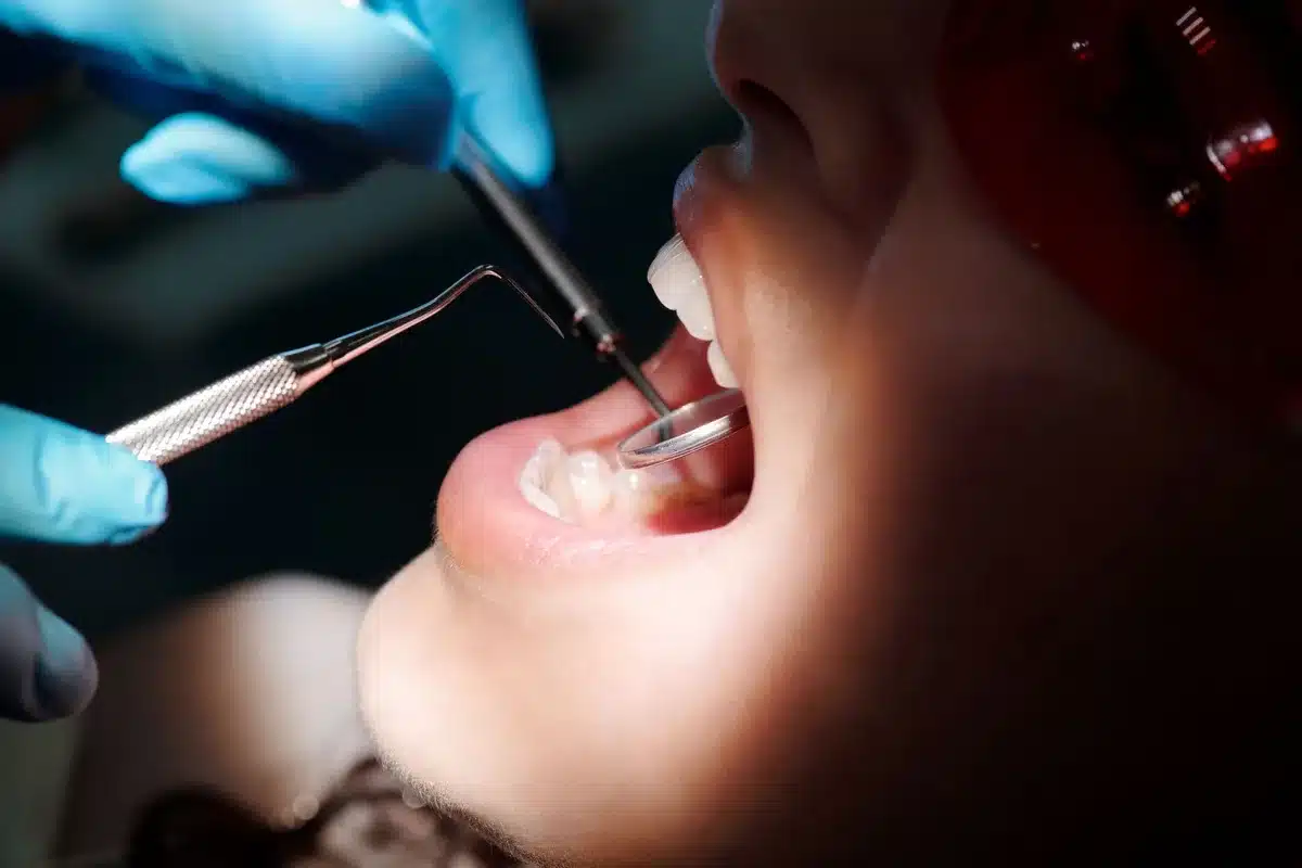 Enfant chez le dentiste lors d'un examen dentaire montrant une inflammation dentaire