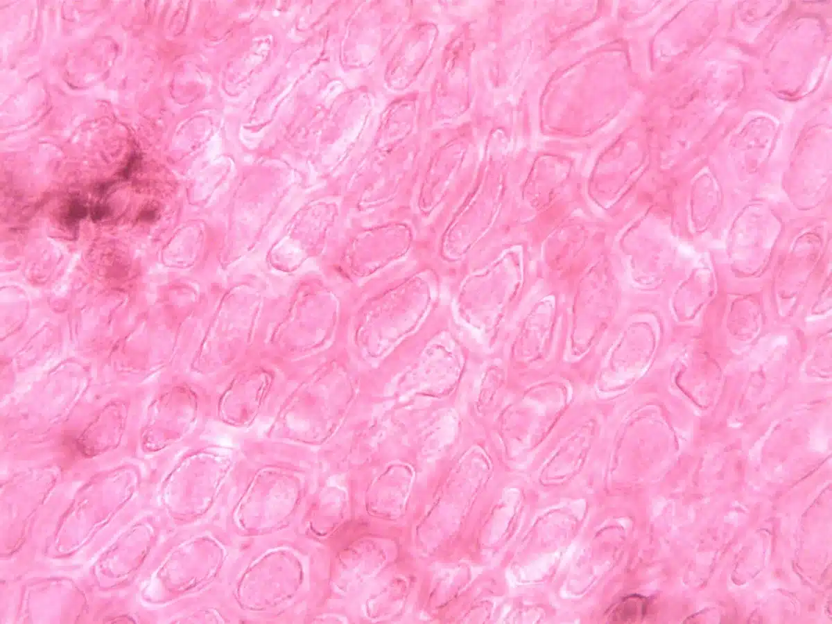 Illustration microscopique montrant les mélanocytes dans les couches de la peau.