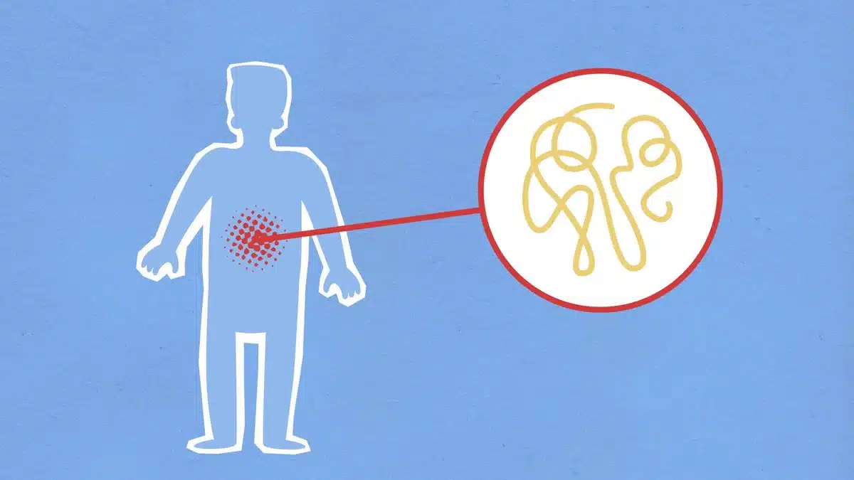 Illustration conceptuelle de l'inflammation intestinale et des processus digestifs affectant l'absorption des nutriments
