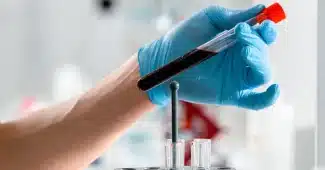 Vial de sang et données numériques de biomarqueurs protéiques dans un laboratoire médical