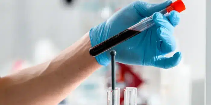 Vial de sang et données numériques de biomarqueurs protéiques dans un laboratoire médical