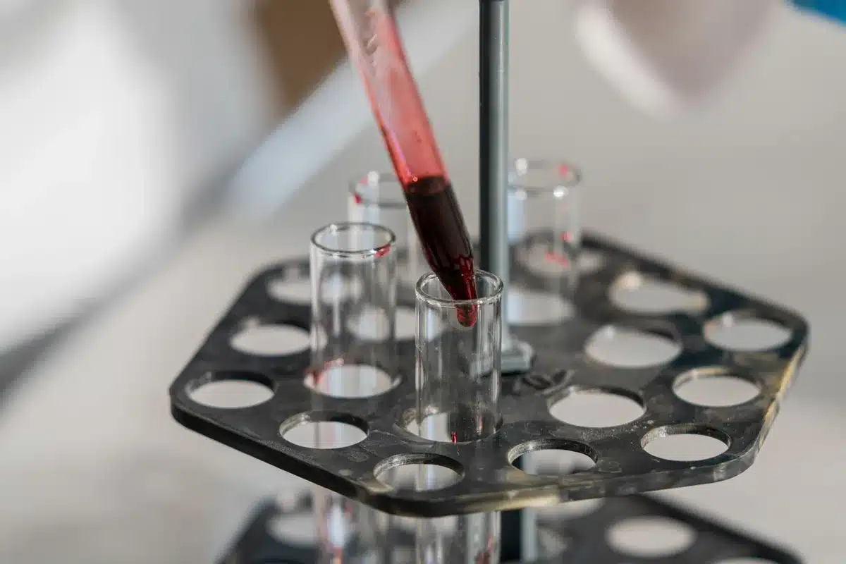 Prélèvement sanguin en laboratoire pour analyse biologique.