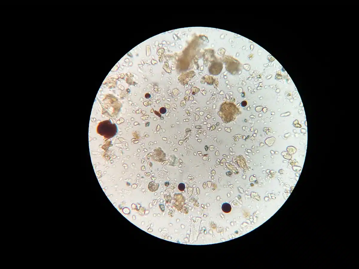 Vue d'un échantillon de laboratoire illustrant la moelle osseuse et les cellules sanguines
