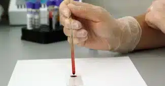 Questionnaires médicaux et stylo sur un bureau de consultation en plein jour