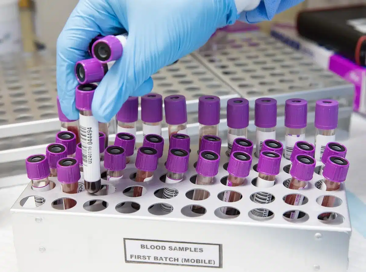 Prélèvements en laboratoire pour tests biologiques (cheveux, salive, urine)
