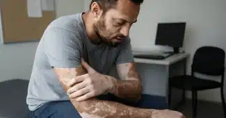 Vitiligo : causes, mécanismes et facteurs de la dépigmentation cutanée